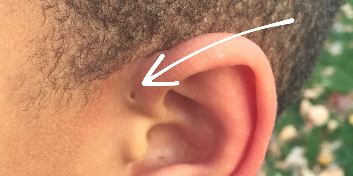 Ear holes