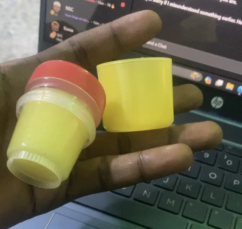 “Daylight robbery” — Man cries out after being deceived by popular ointment packaging 